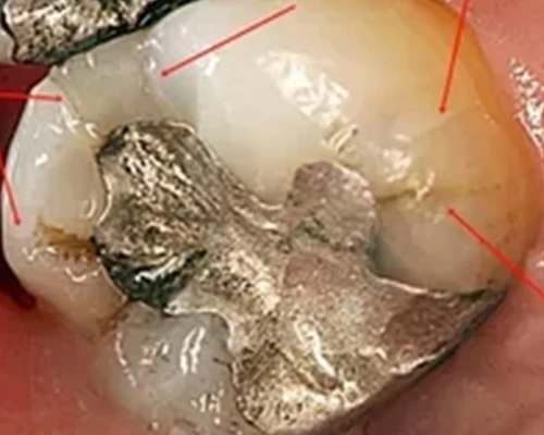 Stuffed animals do not suffer from decay Alsundos Dental Complex
